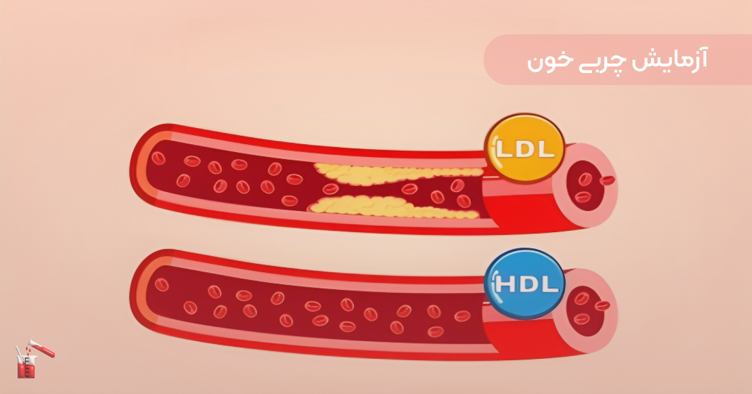 تفسیر جواب آزمایش خون : چه چیزی طبیعی است و چه چیزی غیرطبیعی؟