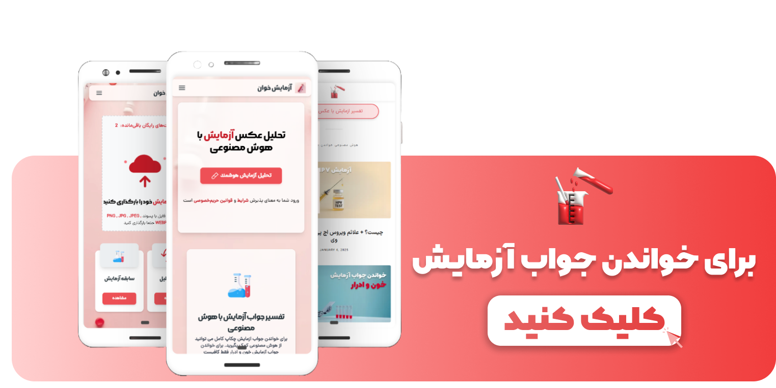خواندن جواب آزمایش با دوربین برای ایفون